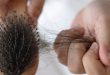 Solusi Rambut Rontok dan Ketombe Kenali Penyebab dan Cara Mengatasinya