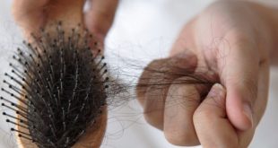 Solusi Rambut Rontok dan Ketombe Kenali Penyebab dan Cara Mengatasinya